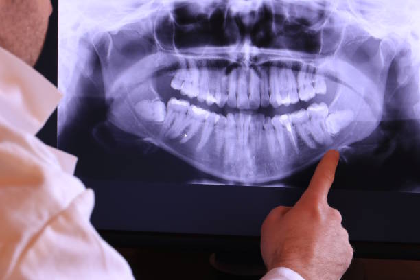 Best Emergency Dentist for Lost Fillings or Crowns in Tumter, WA